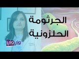 ما هي جرثومة المعدة الحلزونية وما تأثيراتها؟