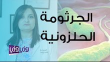 ما هي جرثومة المعدة الحلزونية وما تأثيراتها؟