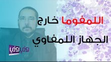 تشخيص وعلاج الليمفوما خارج الجهاز الليمفاوي