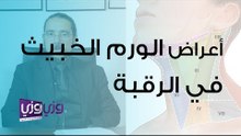 أعراض الورم الخبيث في الرقبة