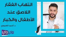 التهاب الفقار اللاصق عند الأطفال والكبار
