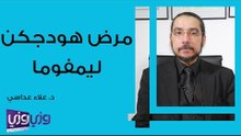 مرض هودجكن ليمفوما