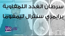 سرطان الغدد اللمفاوية برايمري سنترال ليمفوما