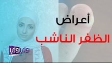 أعراض الظفر الناشب