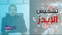 هل تحليل الدم الشامل يكشف الإيدز
