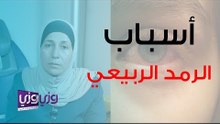 أسباب الرمد الربيعي وعلاجه وطريقة تنظيفه