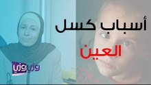 أسباب كسل العين وطرق اكتشافه