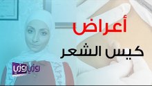أعراض كيس الشعر