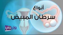أنواع سرطان المبيض