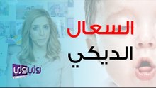 ما هو السعال الديكي وطرق علاجه