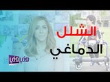 كيف أعرف أن طفلي لديه شلل دماغي