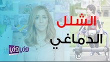 كيف أعرف أن طفلي لديه شلل دماغي