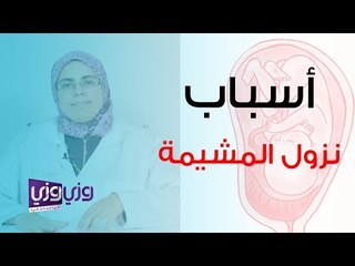 أسباب نزول المشيمة