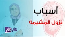 أسباب نزول المشيمة