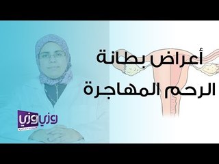أعراض بطانة الرحم المهاجرة
