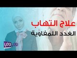 علاج التهاب الغدد اللمفاوية