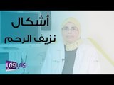 أشكال نزيف الرحم وأسبابه