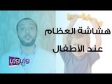 هشاشة العظام عند الأطفال