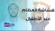 هشاشة العظام عند الأطفال