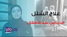 علاج الشلل الدماغي عند الأطفال