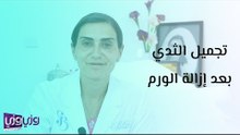 تجميل الثدي بعد إزالة الورم