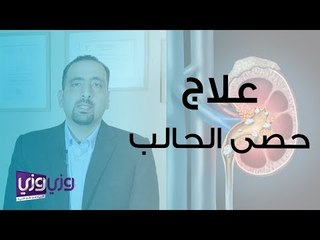 علاج حصى الحالب