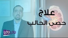 علاج حصى الحالب