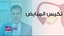 ما هو تكيس المبايض وما هي العوامل المسببة له