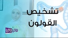 تشخيص القولون العصبي