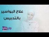 علاج البواسير بدون ألم - التدبيس P P H