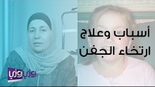 أسباب وعلاج ارتخاء الجفن