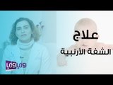 علاج الشفة الأرنبية وفتحة سقف الحلق