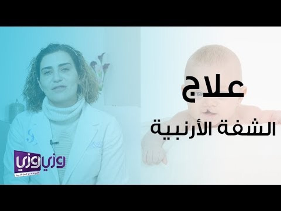 علاج الشفة الأرنبية وفتحة سقف الحلق