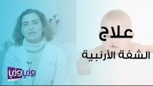 علاج الشفة الأرنبية وفتحة سقف الحلق