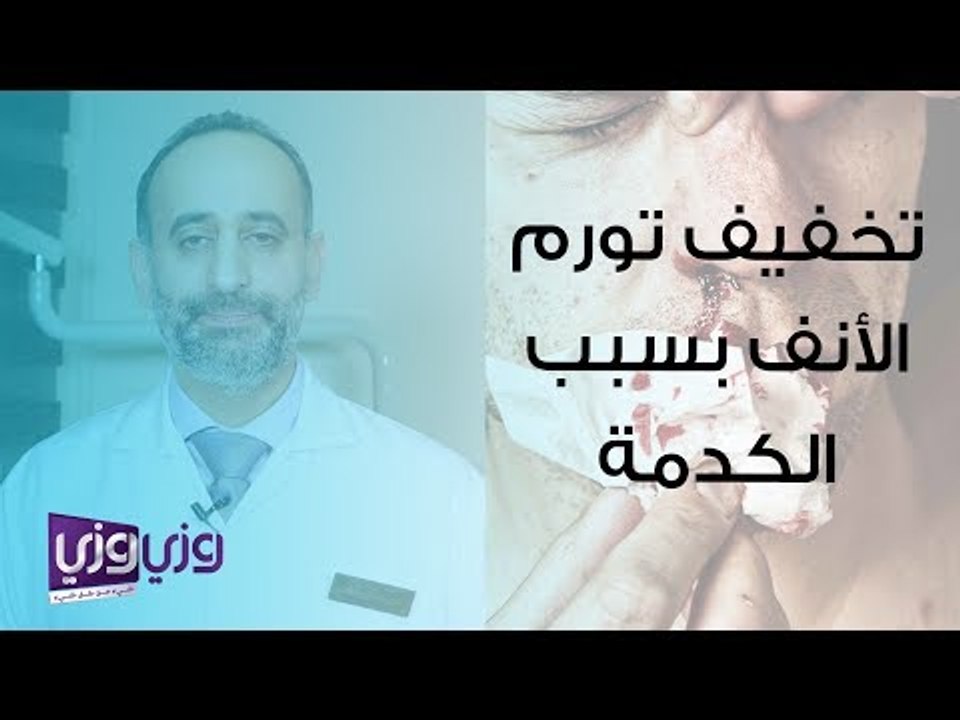طرق تخفيف تورم الأنف بسبب الكدمات