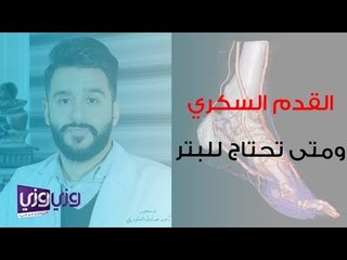 القدم السكرى ومتى تحتاج إلى بتر؟