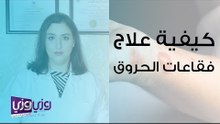 كيفية علاج فقاعات الحروق