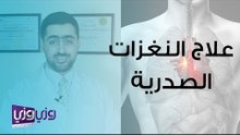 علاج النغزات الصدرية