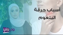 أسباب حرقة البلعوم وعلاجه