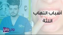 أسباب التهاب اللثة