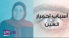 أسباب احمرار العين وعلاجه