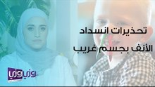 تحذيرات عند انسداد الأنف بجسم غريب عند الأطفال
