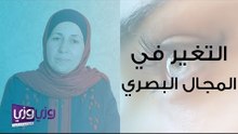 أسباب التغير في المجال البصري