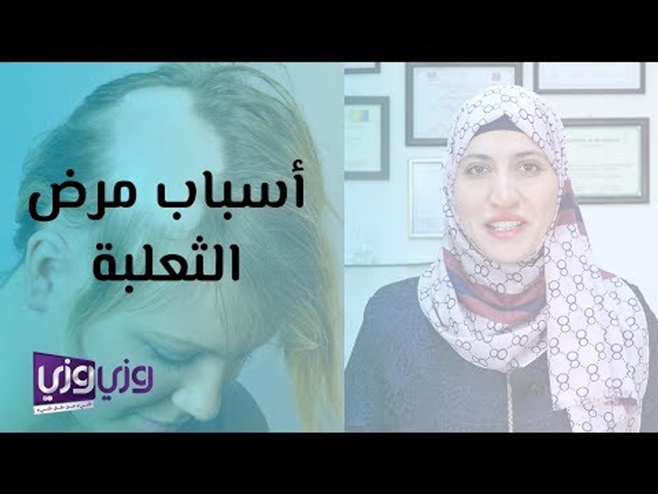 أسباب مرض الثعلبة وعلاجه