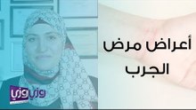 أعراض مرض الجرب وعلاجه