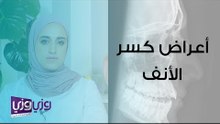 أعراض كسر الأنف وتشخيصه