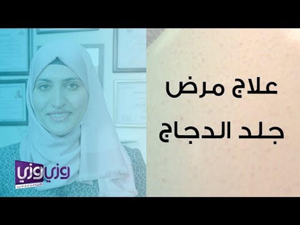 مرض جلد الدجاج أسبابه وعلاجه