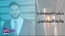 مرض الهيموفيليا وارتباطه بآلام المفاصل