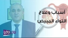 أسباب وعلاج التواء المبيض