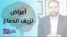 أعراض نزيف الدماغ وعلاجه